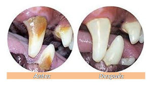 Profilaxis Dental